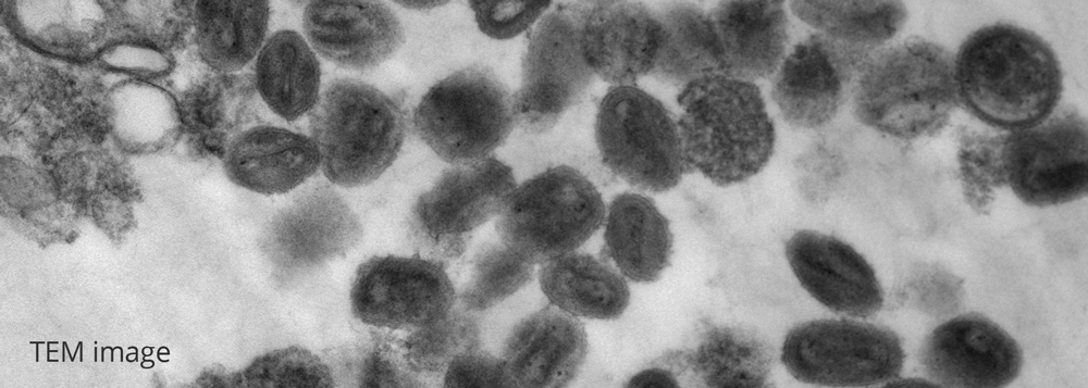 electron microscope images virus